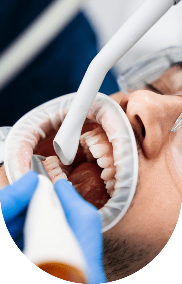 Airflow Dental Treatment