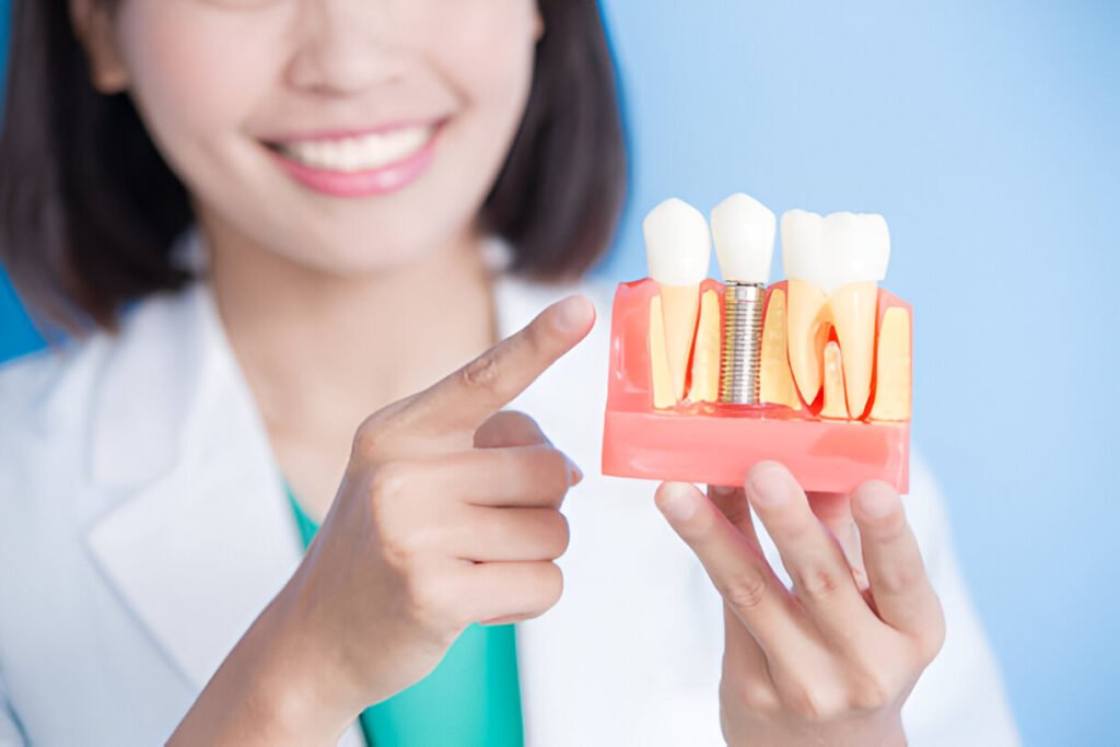 How Many Teeth Can Dental Implants Replace?