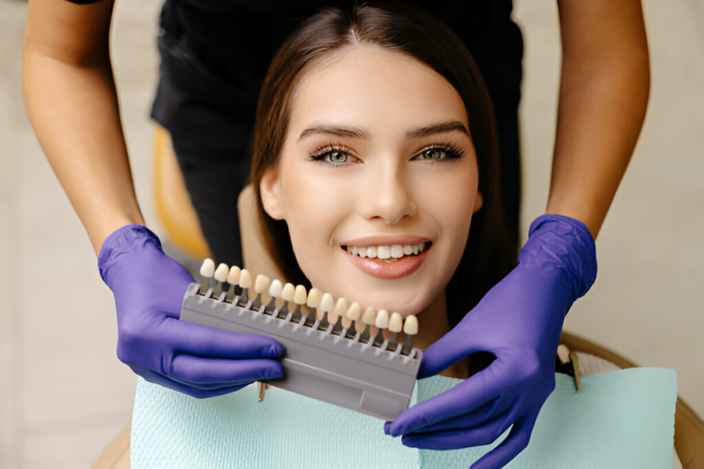 Veneers