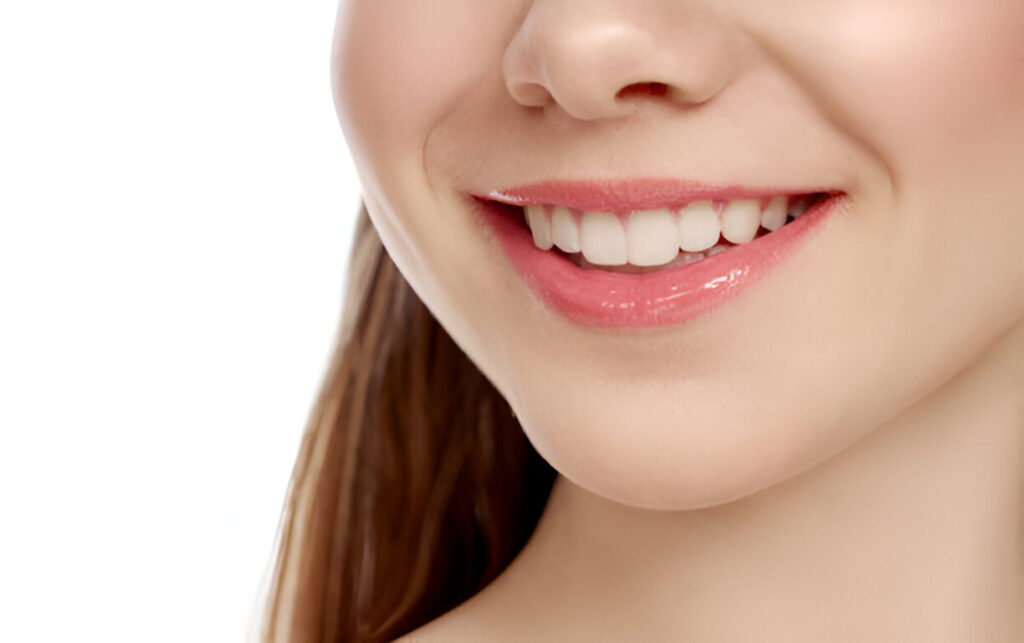 Teeth whitening