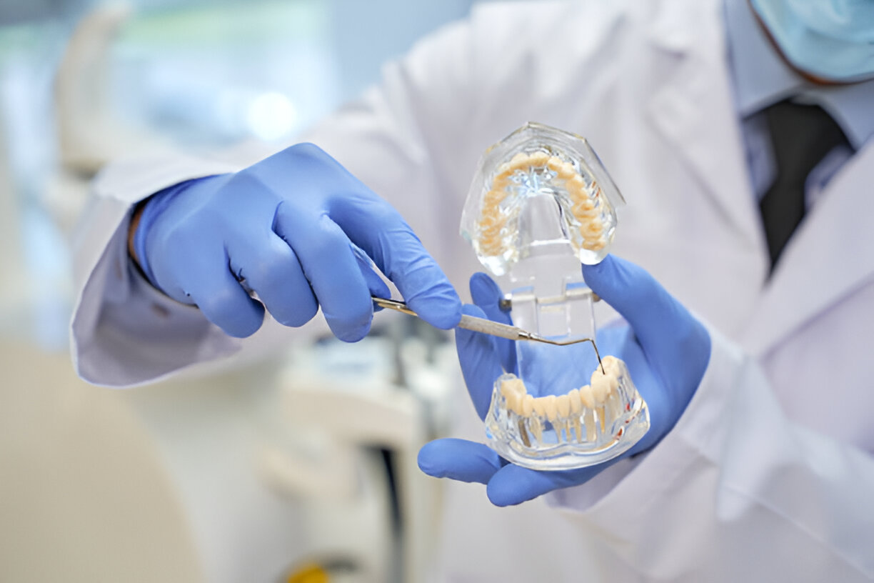 Dental Implants